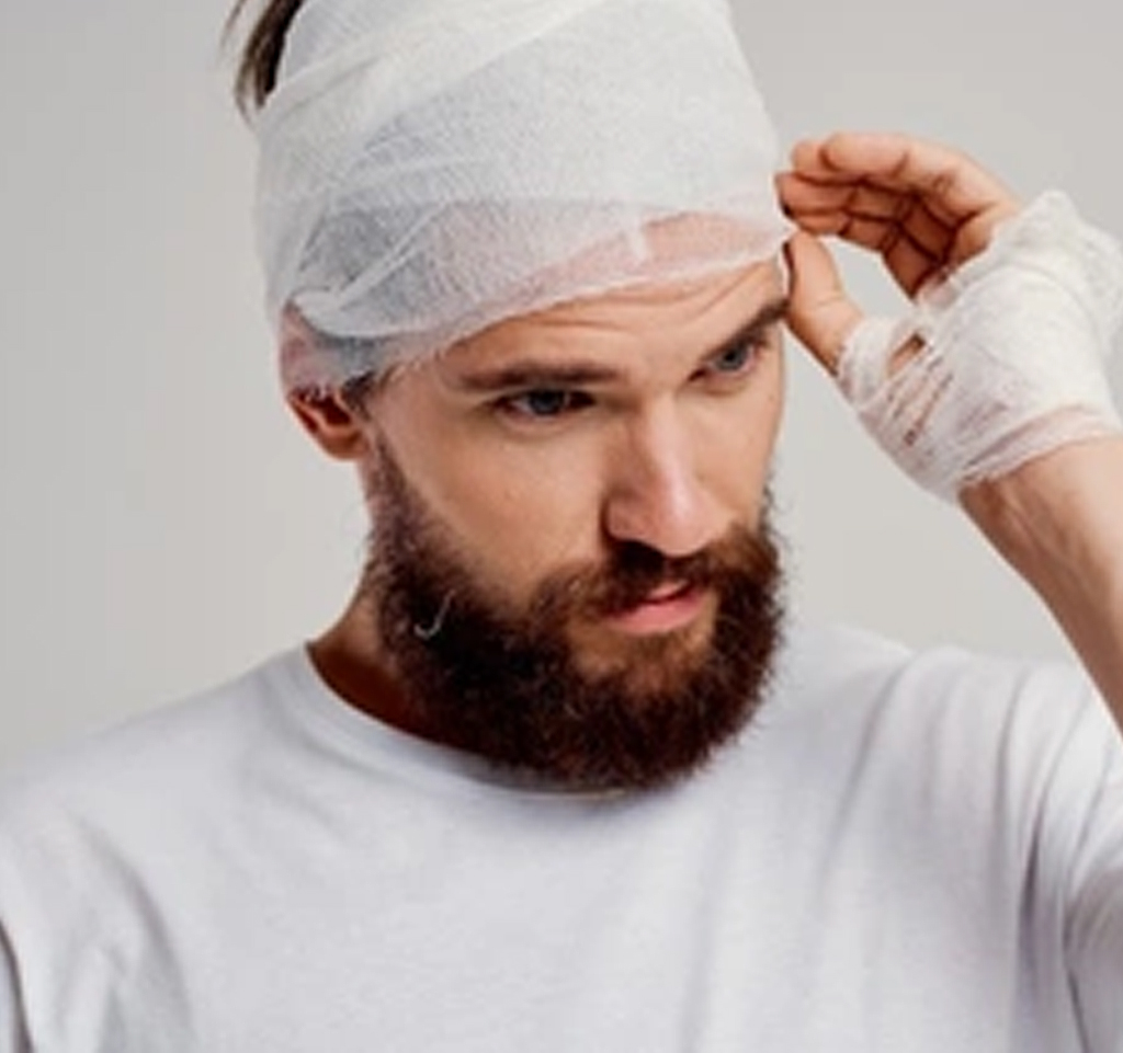 Hombre con su cabello perfecto despues de pasar el posoperatorio de un transplante capilar